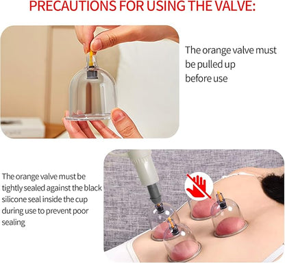 Complete Vacuum Cupping Set with 32 Silicone Cups & Manual Pump